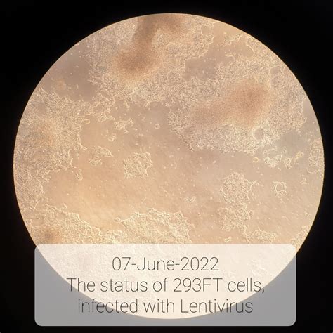 Can 293Ft Cells That Have Been Detached By Pbs Become Lentiviruses Researchgate