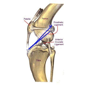 Cruciate Ligament In Dogs Results For Yahoo Image Search Results